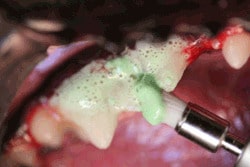 歯石除去 スケーリング 犬の歯医者さん Ocean S Dog Dental Clinic 歯石除去 スケーリング 犬の歯医者さん Ocean S Dog Dental Clinic